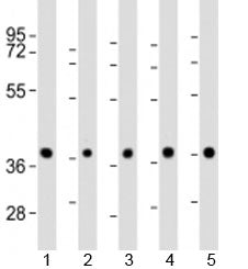 Western blot testing of 1) mouse BA/F3 cell lysate and human 2) HeLa, 3) K562, 4) MCF-7 and 5) Raji