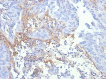 IHC staining of FFPE human lung tissue with TNC antibody (clone TNC/4806). HIER: boil tissue section