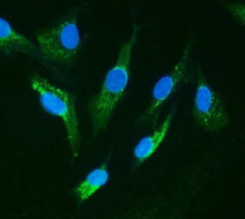 Immunofluorescent staining of FFPE human A549 cells with IRAK1 antibody (green) and DAPI nuclear sta