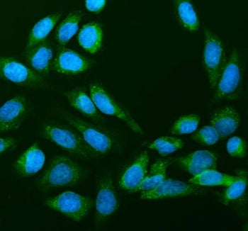 Immunofluorescent staining of FFPE human U-2 OS cells with 40S ribosomal protein S14 antibody (green