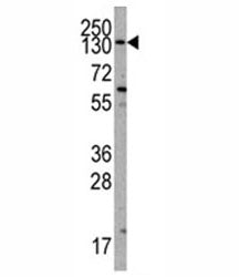 Western blot analysis of PIK3CA antibody and K562 lysate. Predicted molecular weight ~110 kDa.