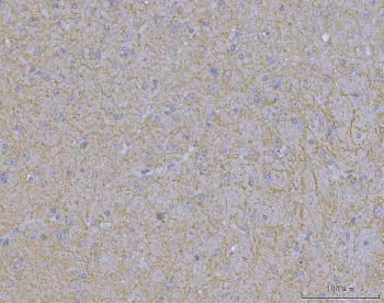 IHC staining of FFPE mouse brain tissue with WDR7 antibody. HIER: boil tissue sections in pH8 EDTA f