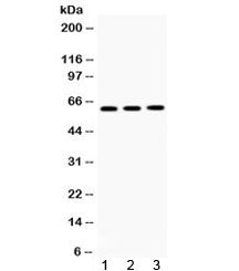 TCP1 theta Antibody / CCT8