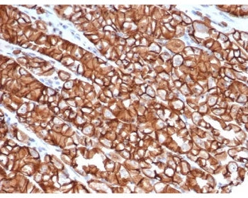 IHC staining of FFPE human stomach tissue with recombinant Cadherin 1 antibody (clone rCDH1/6769). H