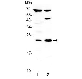 Western blot testing of 1) rat brain and 2) human PANC-1 lysate with TRFP antibody at 0.5ug/ml. Pred