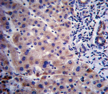 IHC staining of FFPE human liver tissue with CYP3A4 antibody. HIER: steam section in pH6 citrate buf