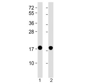 Western blot testing of 1) human brain and 2) mouse brain lysate with SNCA antibody at 1:2000. Predi