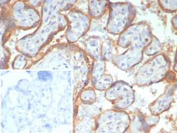 Glypican 3 Antibody / GPC3