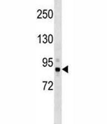 Tbk1 Antibody