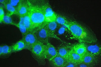 Immunofluorescent staining of FFPE human A431 cells with Beta-2 Microglobulin antibody (green) at 2u