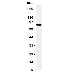 Western blot testing of TRPV2 antibody and HeLa cell lysate. Expected molecular weight: 85-95 kDa de