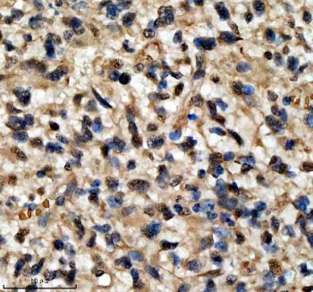 Immunohistochemical staining of QKI using anti-QKI antibody. QKI was detected in a paraffin-embedded