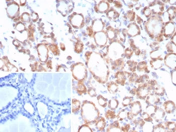 IHC staining of FFPE human thyroid tissue with TrkB antibody (clone NTRK2/7929). Inset: PBS used in