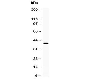 CD48 Antibody (Pan Leukocyte Marker)