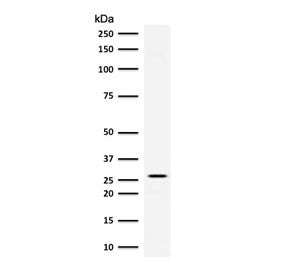 Adiponectin Antibody
