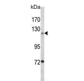FAK Antibody / Focal Adhesion Kinase