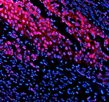 Immunofluorescent staining of TNFAIP2 using anti-TNFAIP2 antibody (red). TNFAIP2 was detected in a p