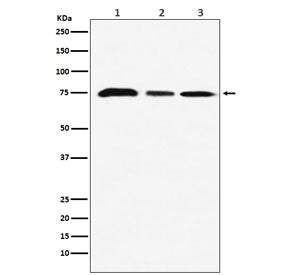 KAT7 Antibody / HBO1 / MYST2