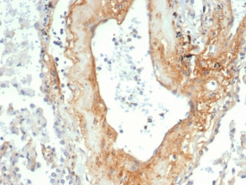 Tenascin C Antibody