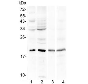 Myoglobin Antibody (N-Terminal Region)