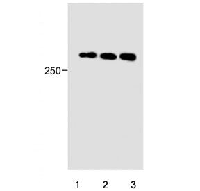 Western blot testing of human 1) HeLa, 2) HepG2 and 3) A549 cell lysate with PIEZO2 antibody. Expect