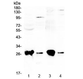 Western blot testing of 1) rat liver, 2) rat lung, 3) mouse liver and 4) mouse lung with GSTT1 antib