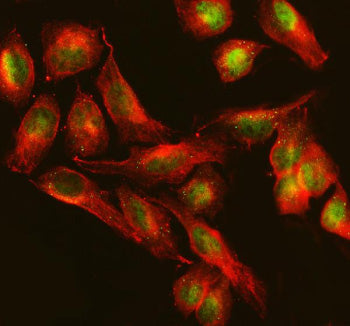 Immunofluorescent staining of TTC34 using anti-TTC34 antibody (green) and anti-Beta Tubulin antibody