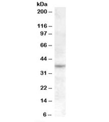 Western blot testing of Jurkat cell lysate with RASSF7 antibody at 1ug/ml. Predicted molecular weigh