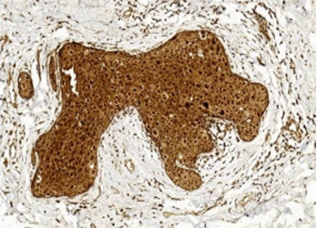 BCOR Antibody