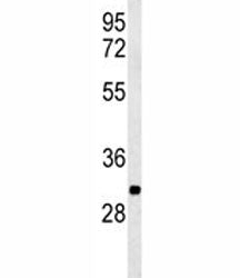 Western blot analysis of PGP antibody and K562 lysate