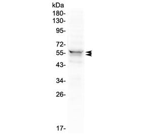 Western blot testing of human 293T cell lysate with LYN antibody at 0.5ug/ml. Predicted molecular we