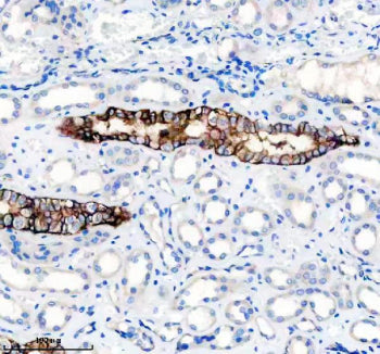 L1CAM Antibody / NCAM-L1 / CD171, 100ul