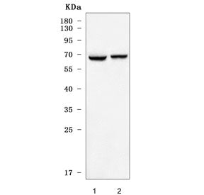 Western blot testing of mouse 1) testis and 2) brain tissue lysate with GPR50 antibody. Predicted mo