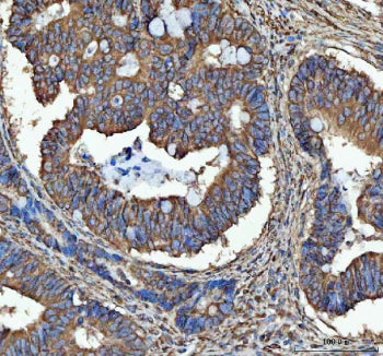 Immunohistochemical staining of SEC61G using anti-SEC61G antibody. SEC61G was detected in a paraffin