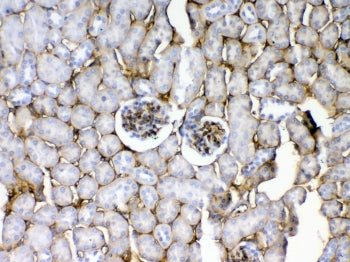 CD105 Antibody / Endoglin