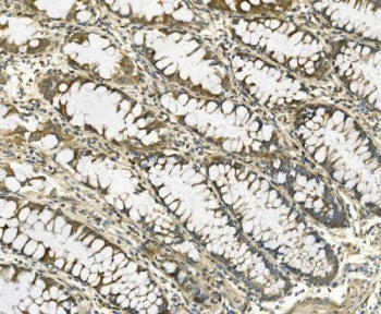 Galectin 2 Antibody / LGALS2