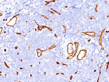 IHC staining of FFPE human tonsil tissue with CD34 antibody (clone SPM123). HIER: boil tissue sectio
