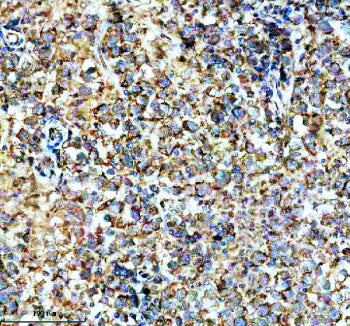Immunohistochemical staining of SPATA6 using anti-SPATA6 antibody. SPATA6 was detected in a paraffin