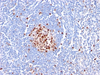 IHC staining of FFPE human tonsil with PCNA antibody (clone PC5). HIER: boil tissue sections in pH 9