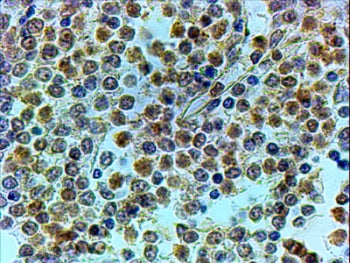 IHC testing of FFPE human spleen with TRIP antibody at 4ug/ml. HIER: steamed with pH6 citrate buffer