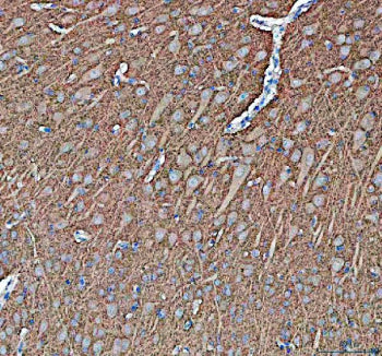 IHC staining of FFPE pig brain tissue with Synapsin II antibody, HRP-secondary and DAB substrate. HI