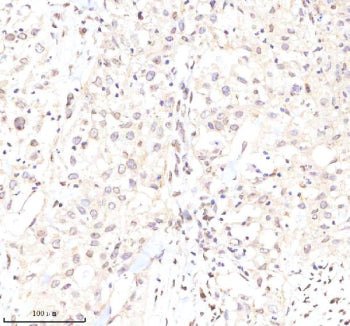 Immunohistochemical staining of Lamin B2 using anti-Lamin B2 antibody. Lamin B2 was detected in a pa