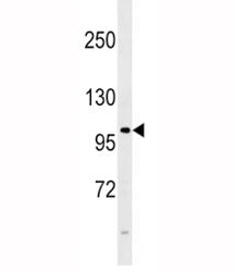 FGFR4 Antibody
