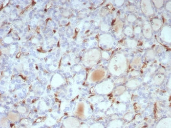 IHC staining of FFPE human thyroid tissue with recombinant TSH Receptor antibody (clone TSHRB/1607R)