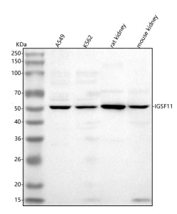 Western blot analysis of IGSF11 using anti-IGSF11 antibody. Lane 1: human whole cell lysates, Lane 2