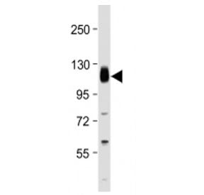 Western blot testing of Thrombomodulin antibody at 1:2000 + human THP1 cell lysate. Expected molecul