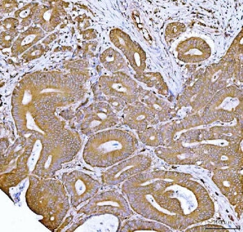 FKBP1A/B Antibody