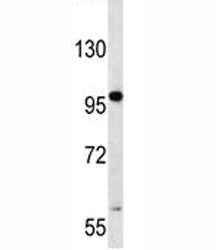 RNF43 antibody western blot analysis in human CCRF-CEM lysate. Predicted molecular weight: 72-95 kDa