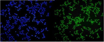 Immunofluorescent staining of FFPE human HeLa cells with MCPIP1 antibody (green) and DAPI nuclear st