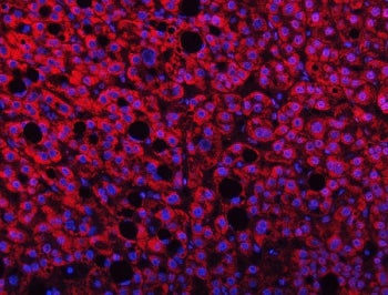 TMPRSS13 Antibody